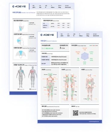 A joint and posture assessment report