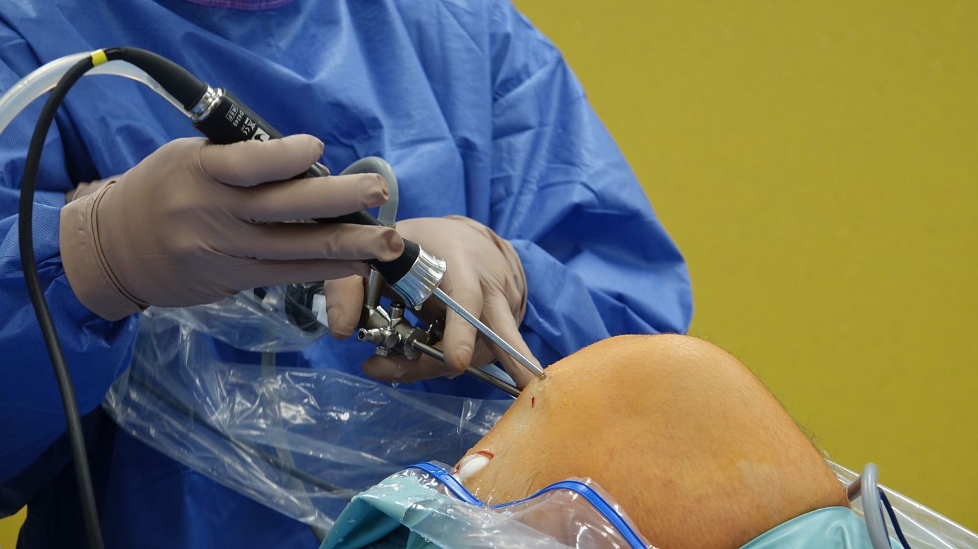 Knee arthroscopy in progress (staged photo)