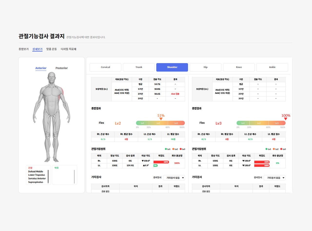A 4DEYE report showing left and right range of motion, muscle balance and risk